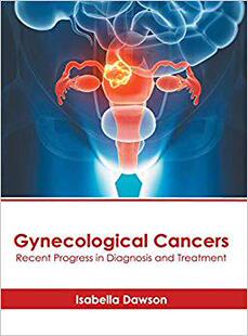 Progress and Treatment Recent Diagnosis Cancers Gynecological 预售