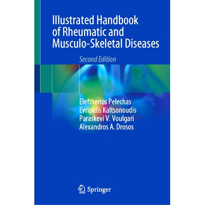 预订 Illustrated Handbook of Rheumatic and Musculo-Skeletal Diseases 风湿病与肌肉骨骼疾病图解手册 第2版: 9783031477423