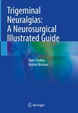 [预订]Trigeminal Neuralgias: A Neurosurgical Illustrated Guide