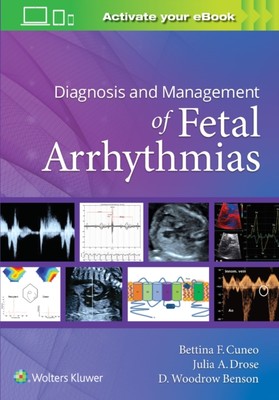 【预订】Diagnosis and Management of Fetal Arrhythmias