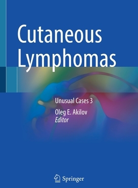 【预订】Cutaneous Lymphomas 9783030591311