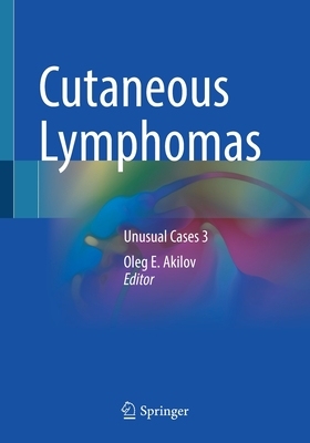 【预订】Cutaneous Lymphomas 9783030591311