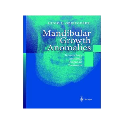 预订 Mandibular Growth Anomalies