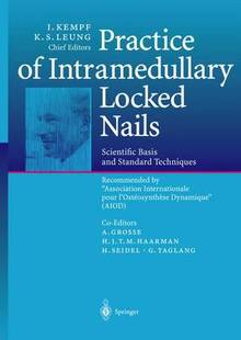 Locked 预订 Intramedullary Nails Practice