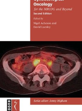 【预订】Gynaecological Oncology for the MRCOG and Beyond