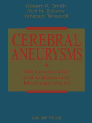 【预订】Cerebral Aneurysms