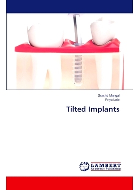 预订 Tilted Implants: 9786207806898