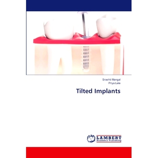 预订 Tilted Implants: 9786207806898