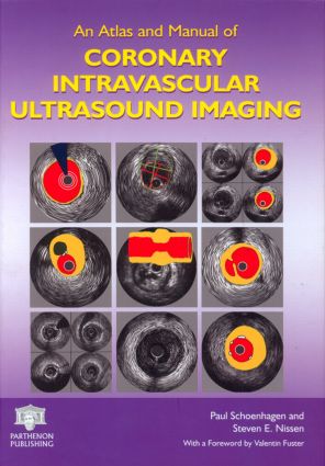 【预订】An Atlas and Manual of Coronary Intravascular Ultrasound Imaging