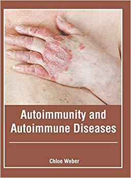 【预售】Autoimmunity and Autoimmune Diseases