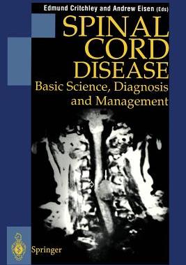 【预订】Spinal Cord Disease