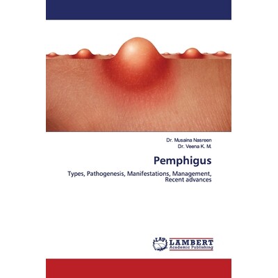 预订 Pemphigus: Types, Pathogenesis, Manifestations, Management, Recent advances: 9786200095299