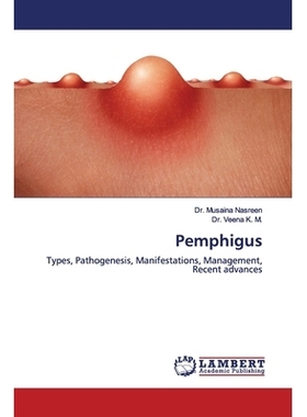 预订 Pemphigus: Types, Pathogenesis, Manifestations, Management, Recent advances: 9786200095299