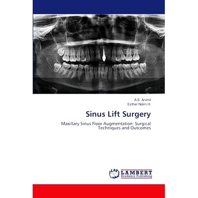 预订 Sinus Lift Surgery: 9786208223298