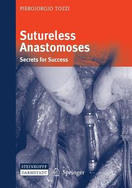 【预订】Sutureless Anastomoses