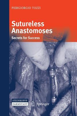 【预订】Sutureless Anastomoses