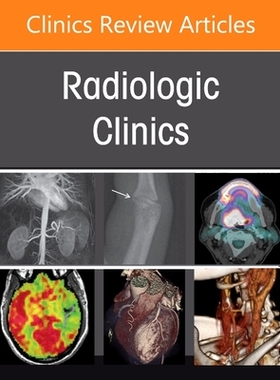 【预订】Update on Incidental Cross-Sectional Imaging Findings, an Issue of Radiologic Clinics  9780323796484