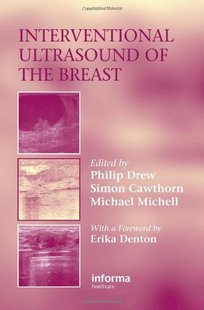 预订 the Interventional Breast Ultrasound