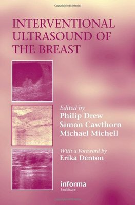 【预订】Interventional Ultrasound of the Breast