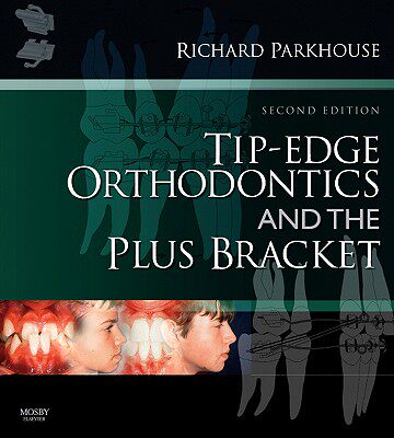 【预订】Tip-Edge Orthodontics and the Plus Bracket