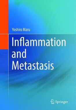 【预订】Inflammation and Metastasis