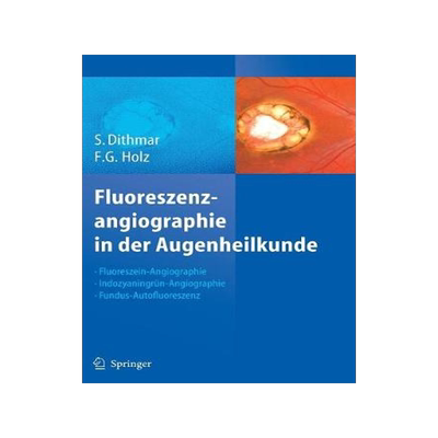 预订 Fluoreszenzangiographie in der Augenheilkunde