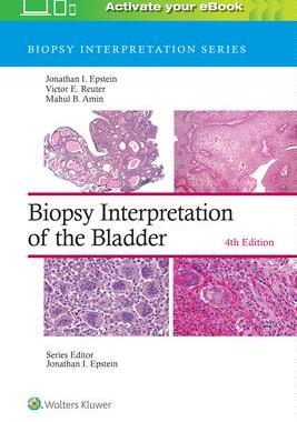 [预订]Biopsy Interpretation of the Bladder 9781975199203