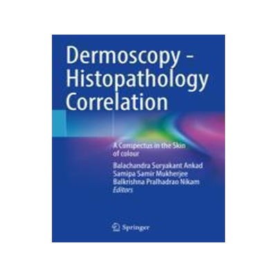 [预订]Dermoscopy - Histopathology Correlation 9789813346406