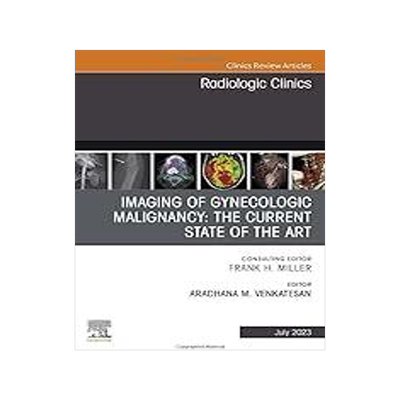 [预订]Imaging of Gynecologic Malignancy 9780323940351