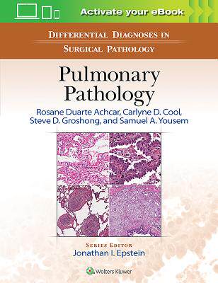 【预订】Differential Diagnoses in Surgical Pathology