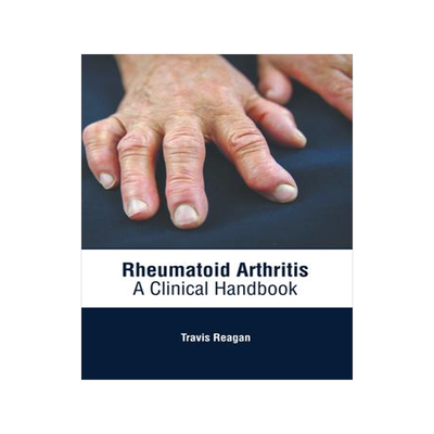 [预订]Rheumatoid Arthritis: A Clinical Handbook 9781639274758