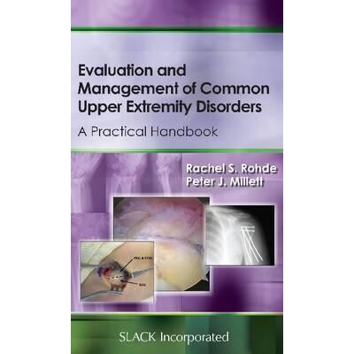 预订 Evaluation and Management of Common Upper Extremity Disorders A Practical Handbook 常见上肢疾病的评估与治疗：实用手