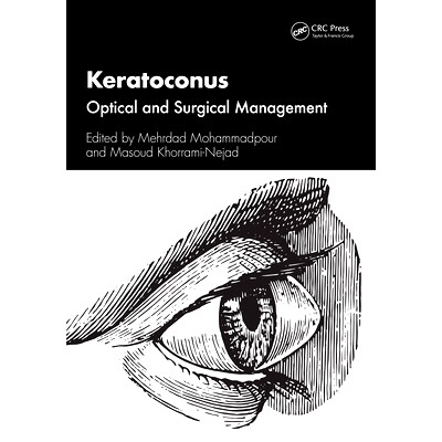 预订 Keratoconus: Optical and Surgical Management 圆锥形角膜:光学与外科管理: 9781032443232