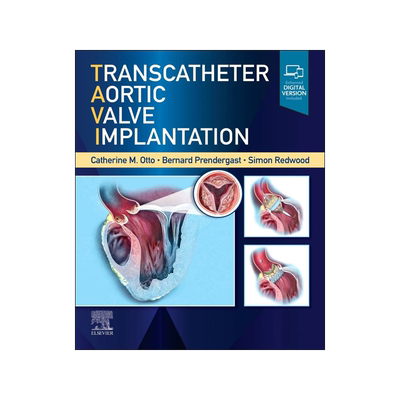 [预订]Transcatheter Aortic Valve Implantation