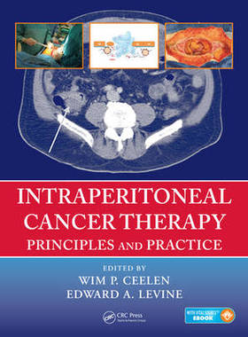 【预订】Intraperitoneal Cancer Therapy