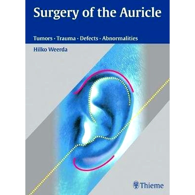 预订 Surgery of the Auricle: Tumors-Trauma-Defects-Abnormalities 耳廓的手术: 9783131394118