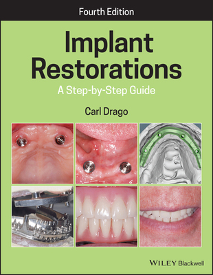 【预订】Implant Restorations - A Step-By-Step Guide