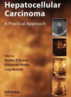 【预订】Hepatocellular Carcinoma