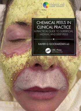 [预订]Chemical Peels in Clinical Practice: A Practical Guide to Superficial, Medium, and Deep Peels 9781032154329