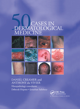 【预订】Fifty Dermatological Cases