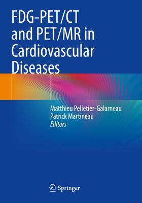 [预订]FDG-PET/CT and PET/MR in Cardiovascular Diseases 9783031098093