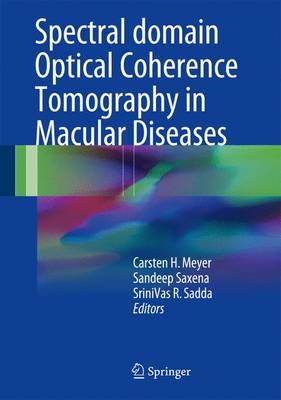 【预订】Spectral Domain Optical Coherence Tomography in Macular Diseases
