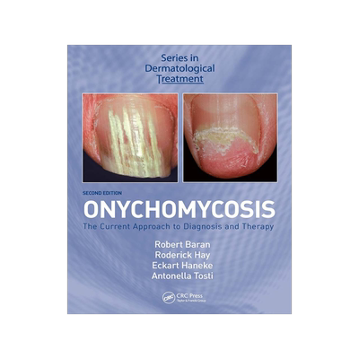 [预订]Onychomycosis
