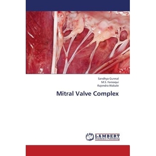 Complex Valve 9783659407574 Mitral 预订