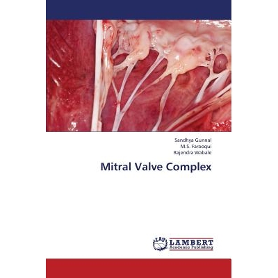 预订 Mitral Valve Complex: 9783659407574