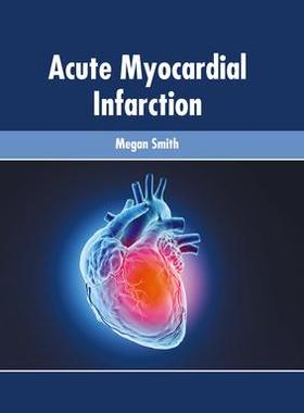 [预订]Acute Myocardial Infarction 9781639270125