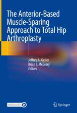 【预订】The Anterior-Based Muscle-Sparing Approach to Total Hip Arthroplasty 9783031020582