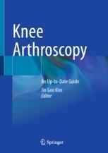 [预订]Knee Arthroscopy 9789811581908