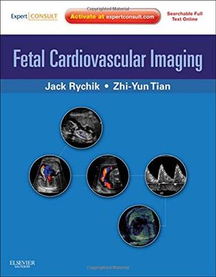 【预订】Fetal Cardiovascular Imaging