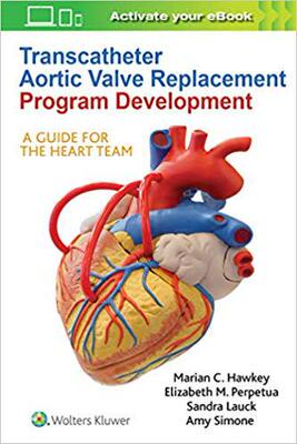 【预订】Transcatheter Aortic Valve Replacement Program Development